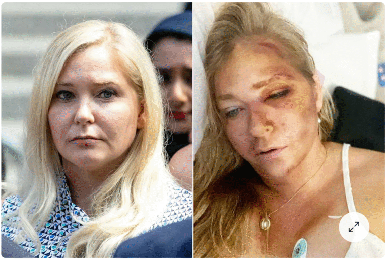 irginia Giuffre before and after alleged assault; left side shows her attending a public event, right side shows her with visible injuries in a hospital bed.