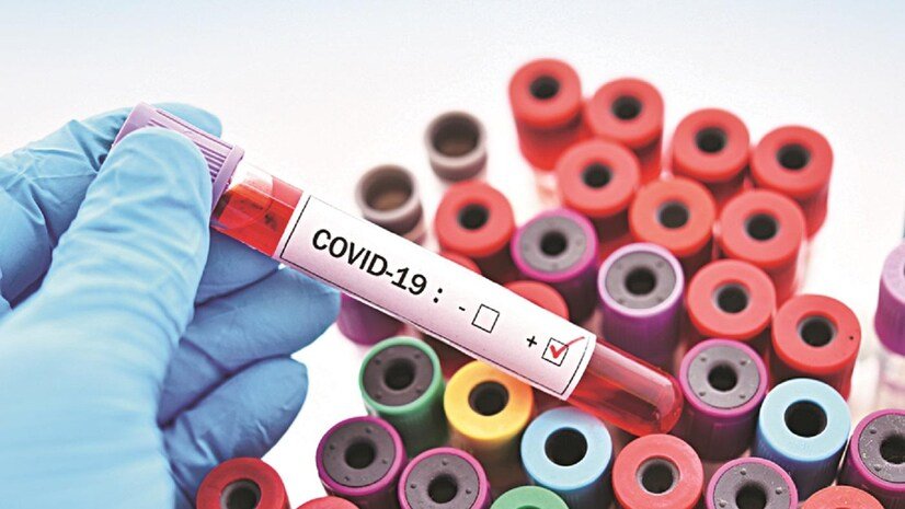 Singapore Covid 19 Cases India Sees Shocking Surge in 2025 With New Variant Triggering Fear and Urgent Warnings Across Asia